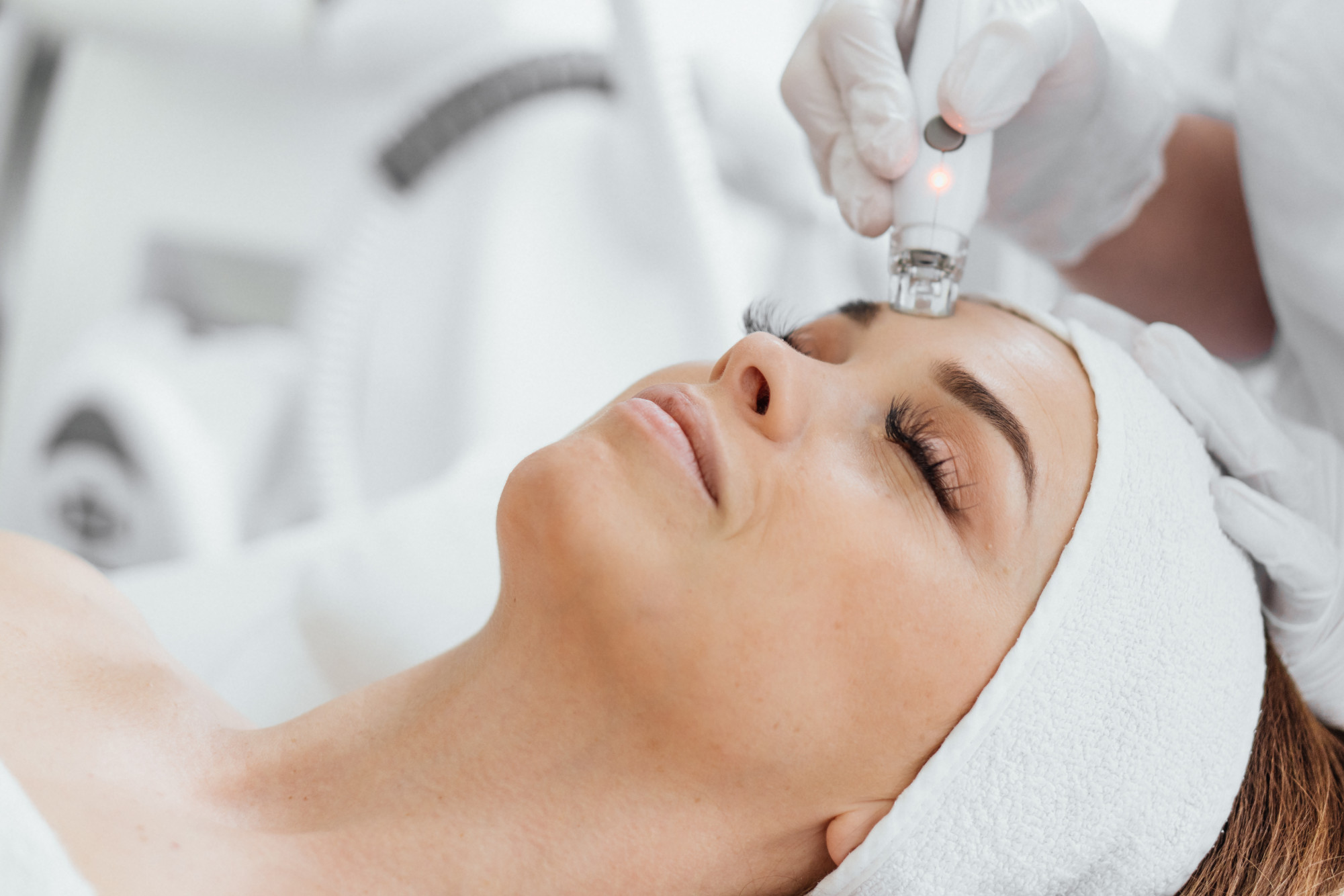 Soin de microneedling combiné aux exosomes pour améliorer la texture et l'éclat de la peau.