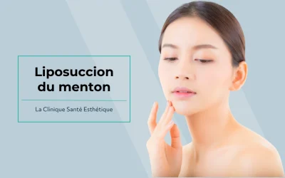 Liposuccion du menton : ce que vous devez savoir
