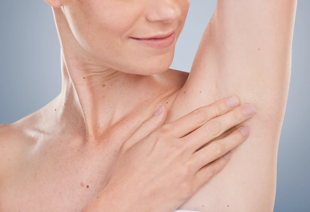 Femme présentant une aisselle sèche et confortable après un traitement médical de l’hyperhidrose axillaire.